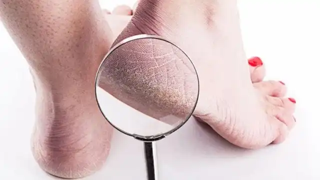 Estética Facial